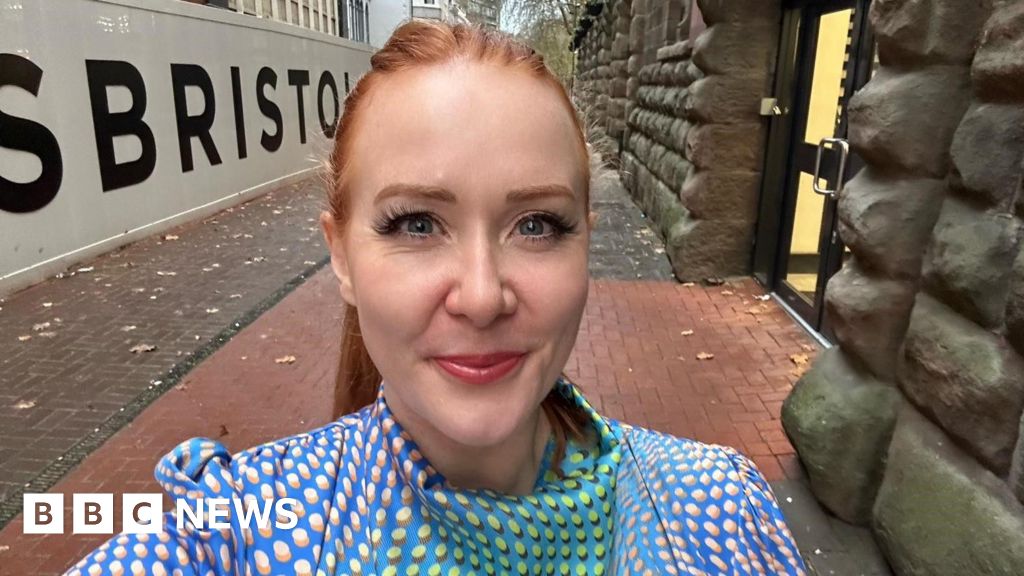 Featured image for Brain Surgery: A Controversial Cure for Migraines