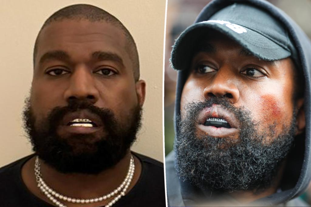 Featured image for "Kanye West's Unconventional Dental Choices and Fashion Statements"