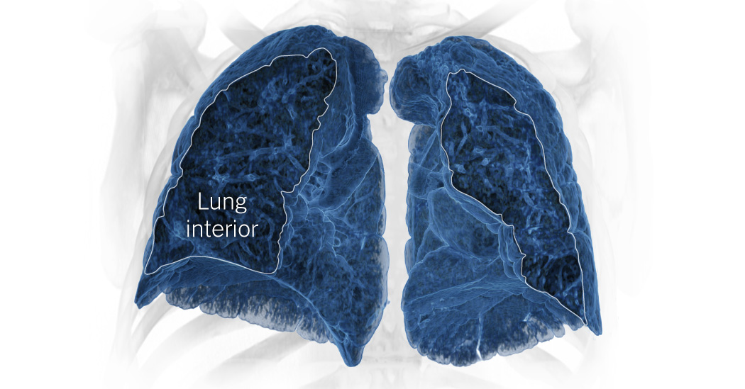 Featured image for The Lingering Effects of Covid on the Lungs