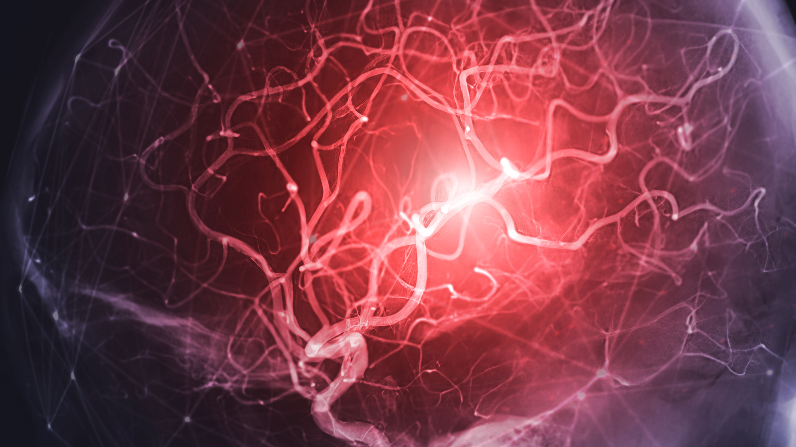 Featured image for Kitchen Whisk Orgasms May Have Triggered Fatal Aneurysm