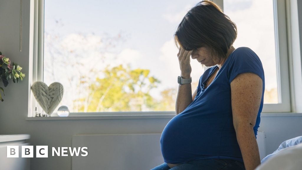 Maternal Mortality: A Growing Concern in the US.