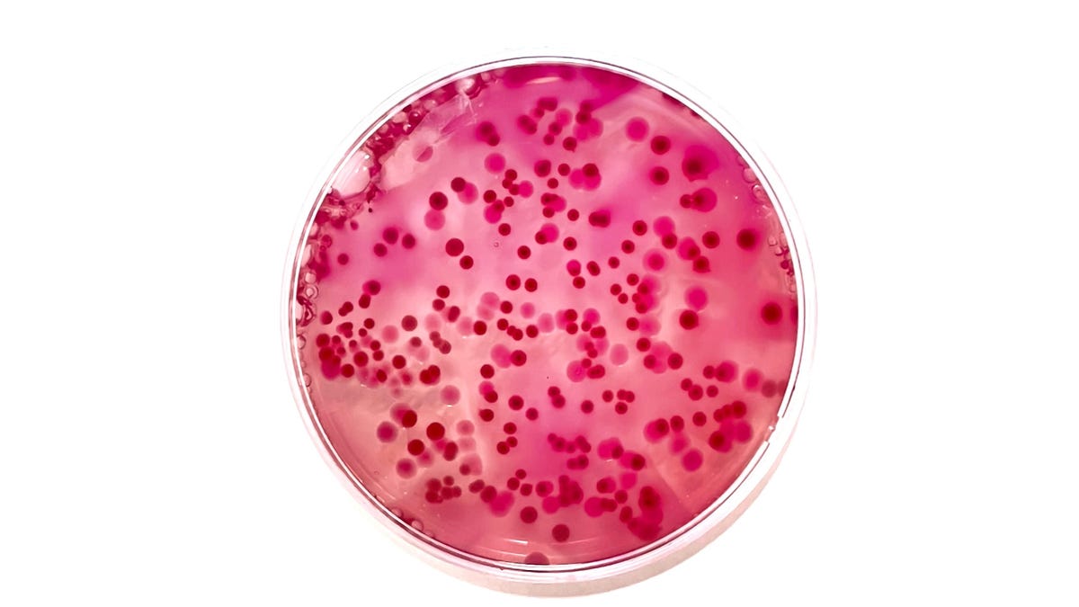 Featured image for "Discovery of 35 New Bacteria Species in Hospital Patients"