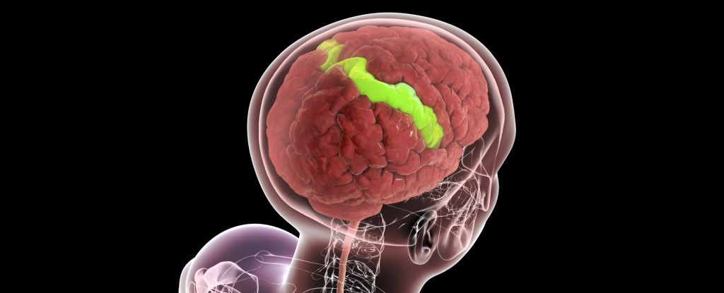 Featured image for Certain Brain Layers Strengthen with Age