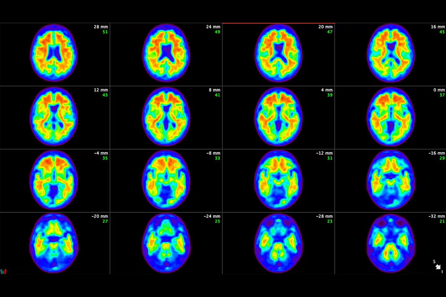 Keep Your Brain Young: Tanzi’s Six Daily Habits for Aging Gracefully