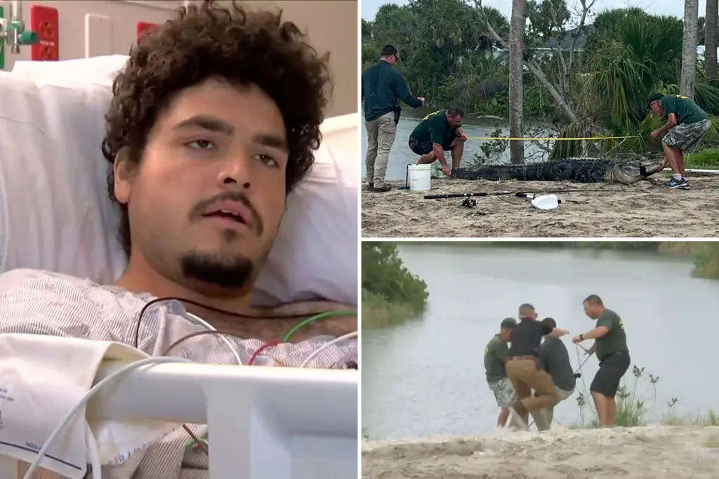 Florida man loses arm in alligator attack while peeing in pond.