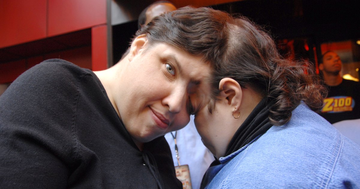 Featured image for "World's Oldest Conjoined Twins, Lori and George Schappell, Pass Away at 62"