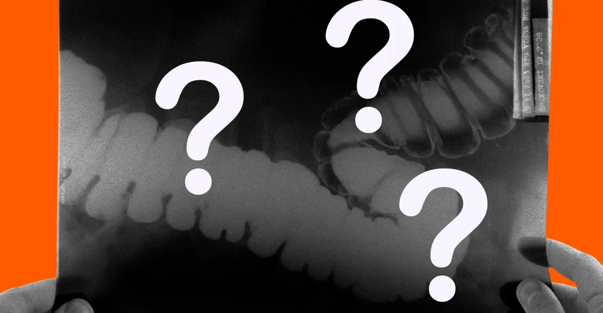 Featured image for AI's Impact on Doctors' Cancer Detection Skills Raises Concerns