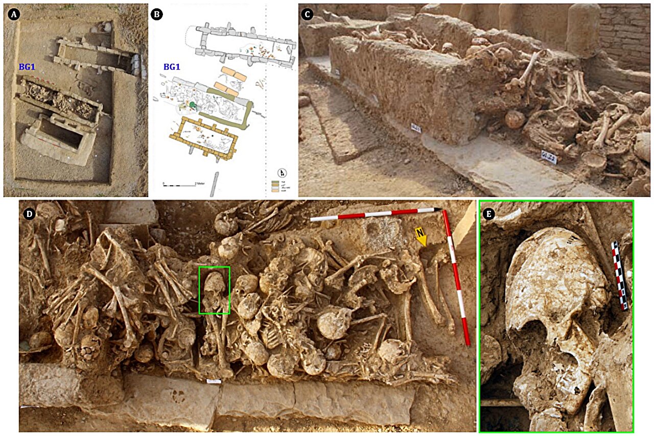 Ancient 6,200-Year-Old Cone-Shaped Skull Reveals Brutal Trauma