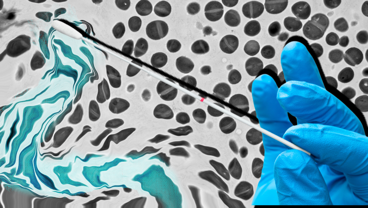 Featured image for Revolutionary Topical Vaccine Cream Replaces Needles Using Skin Bacteria