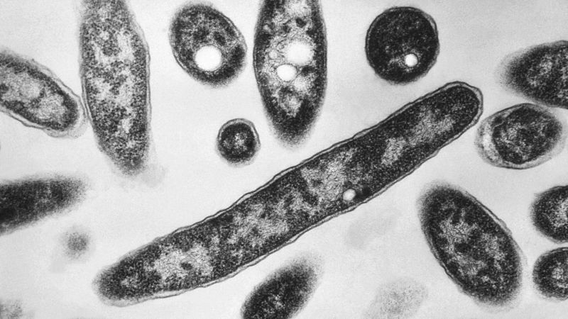 Legionnaires' Disease Outbreak in NYC: 3 Dead, 67 Sick