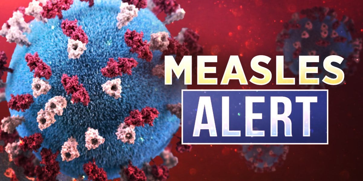 Measles Exposure Alert in St. Louis Metro and Surrounding Counties