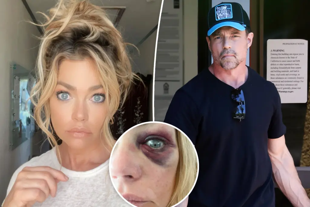 Featured image for Denise Richards Accuses Estranged Husband of Domestic Abuse and Threats
