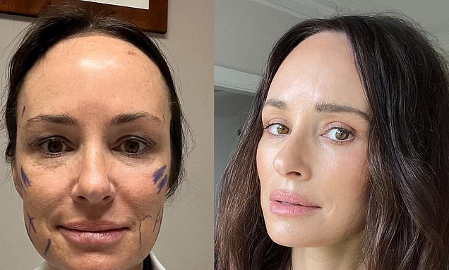 Catt Sadler Opens Up About Her Recent Facelift at 48