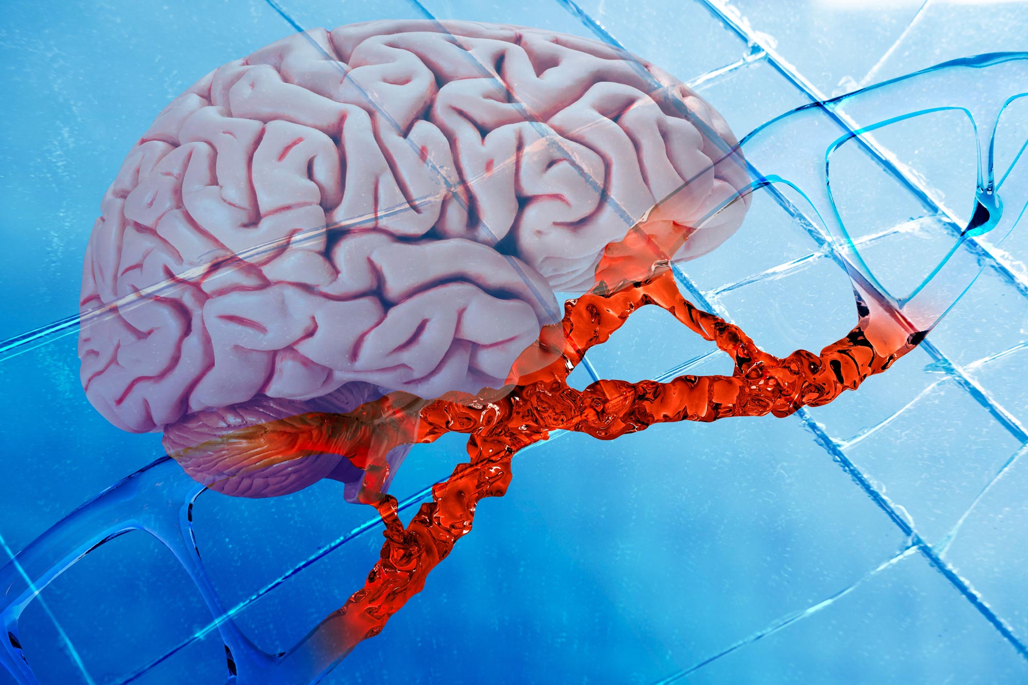 Featured image for Breakthroughs in Alzheimer’s Research: Reversing Disease Signs and Boosting Brain Recovery