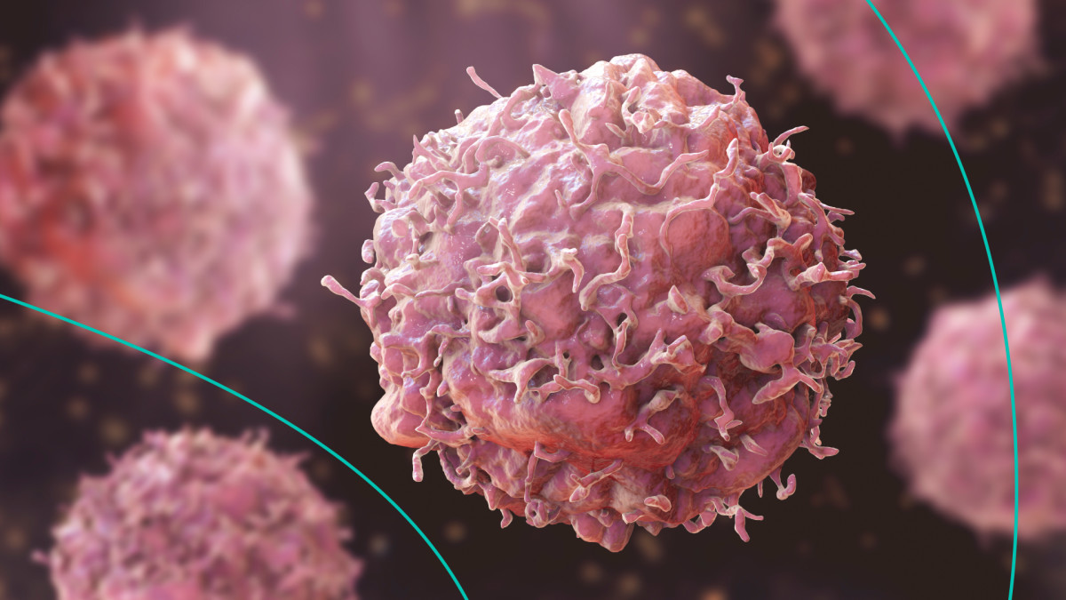 The Rising Cancer Rates Among Millennial Women