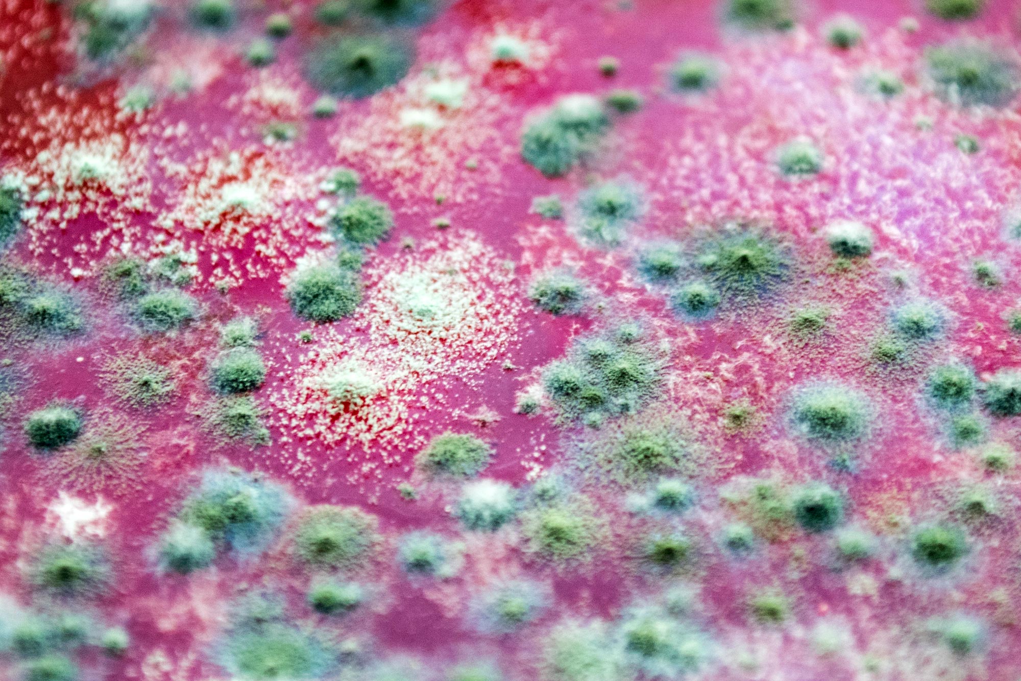 Featured image for Experts Warn Pesticides May Foster Fungal Superbugs and Future Pandemics