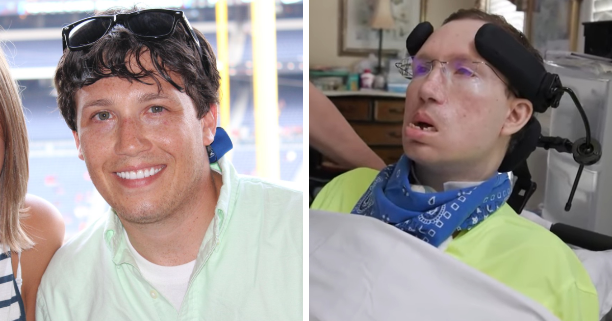 Featured image for Young Man Develops Locked-In Syndrome After Neck Adjustment Error