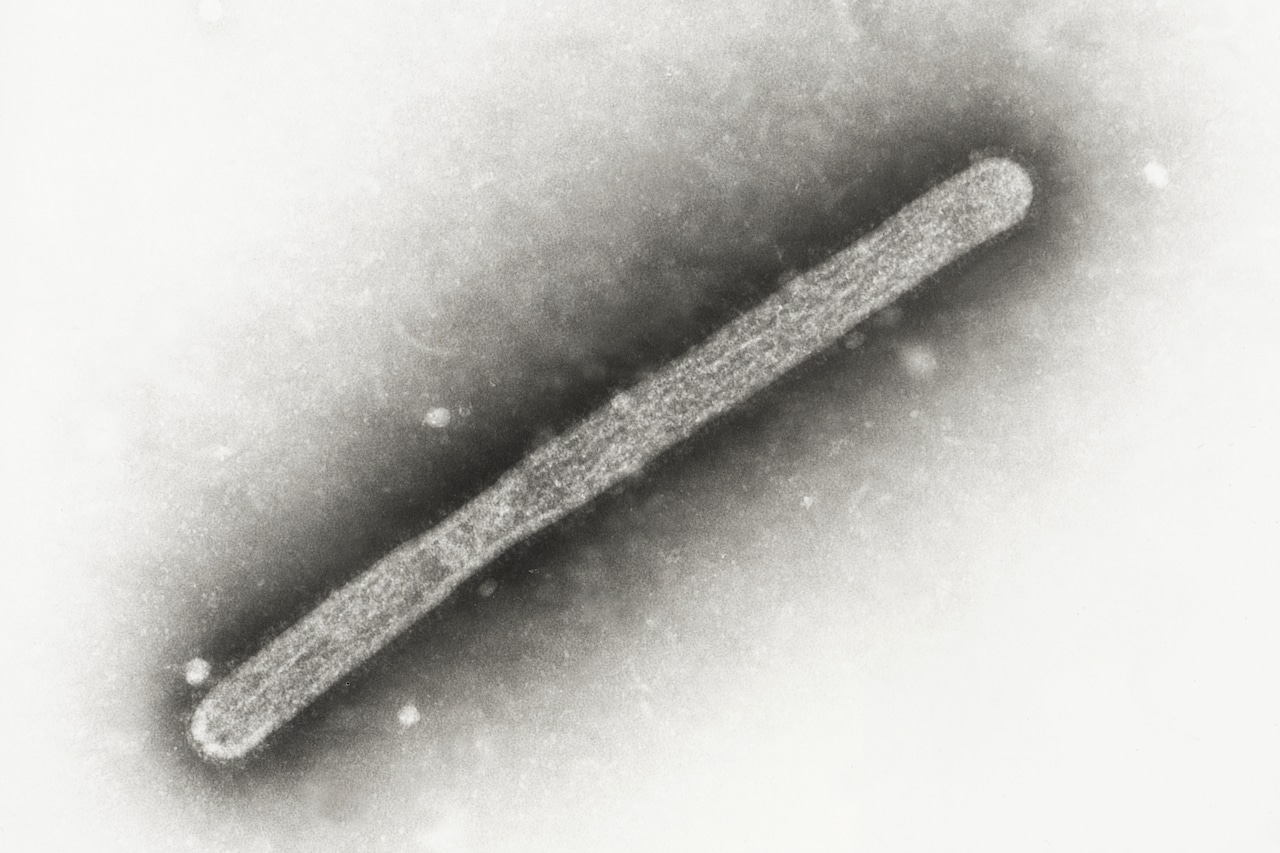 "Bird Flu in US: Rising Human Cases and New Symptoms"