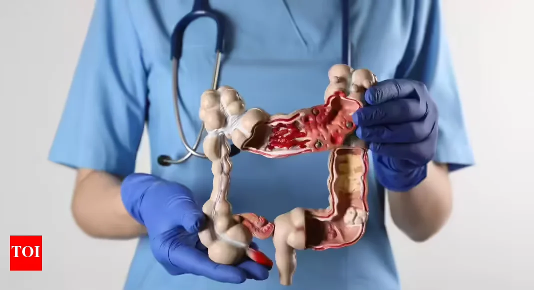 Key Insights and Advances in Colon and Colorectal Cancer Detection and Prevention