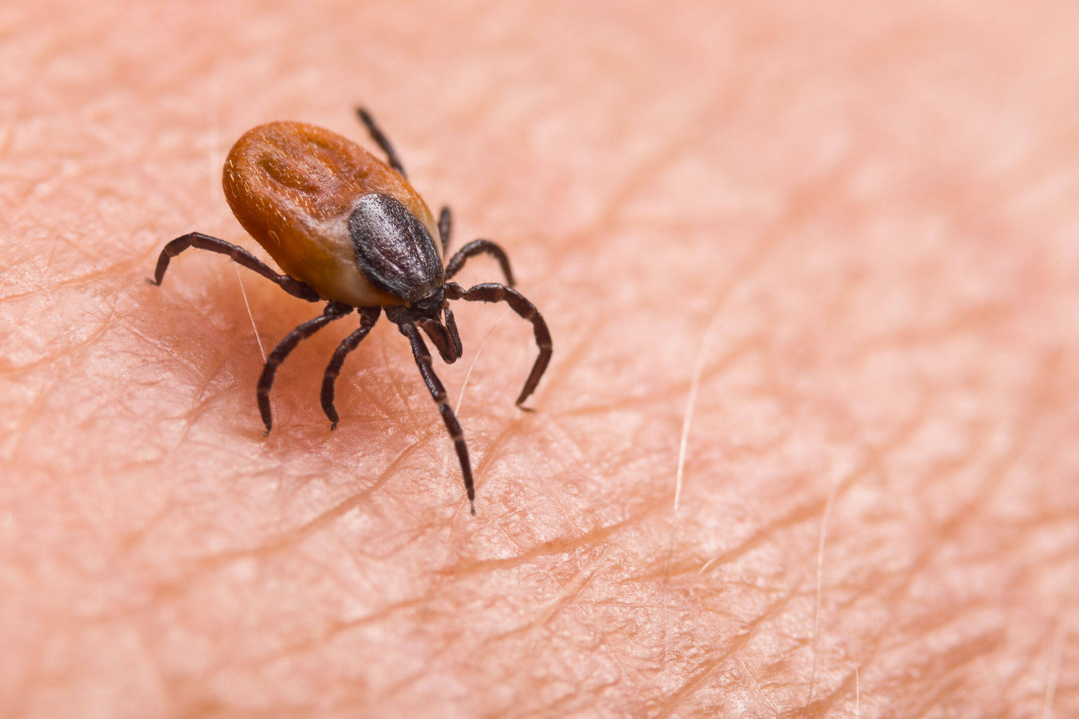 Featured image for Tick season survival guide: Tips to protect yourself and your pets.