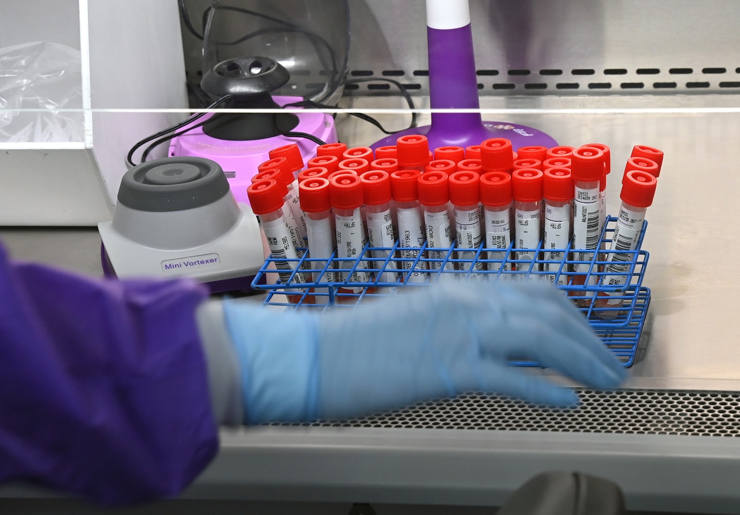 FDA Takes Action to Regulate Unreliable Lab Tests, Ensuring Patient Safety