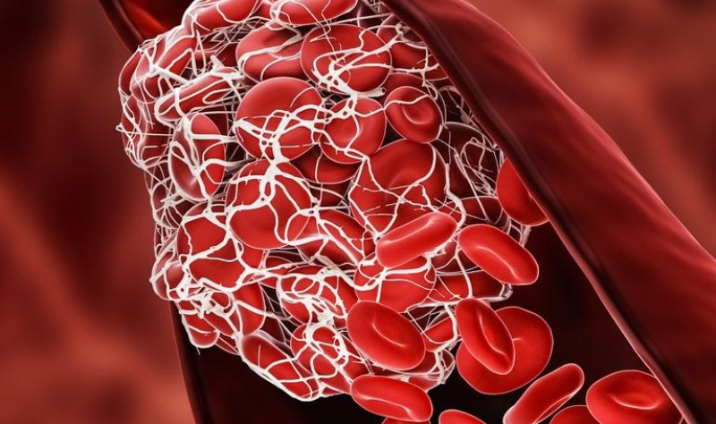 "COVID Vaccines Reduce Risk of Post-Infection Heart Complications and Blood Clots, Study Shows"