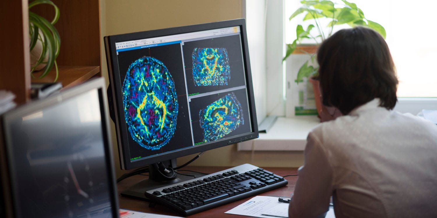 Featured image for Brain scans identify likely candidates for MDMA therapy in trauma treatment