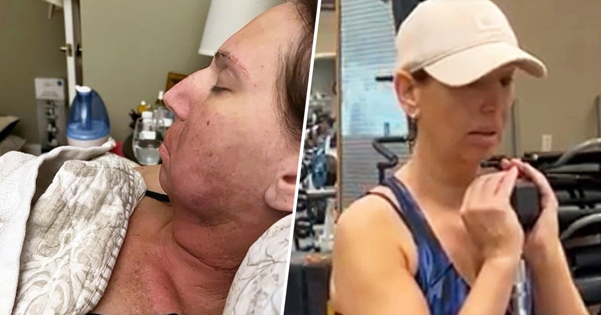 Featured image for "Fitness Empowers Woman's Recovery from Mouth Cancer and Chemo"