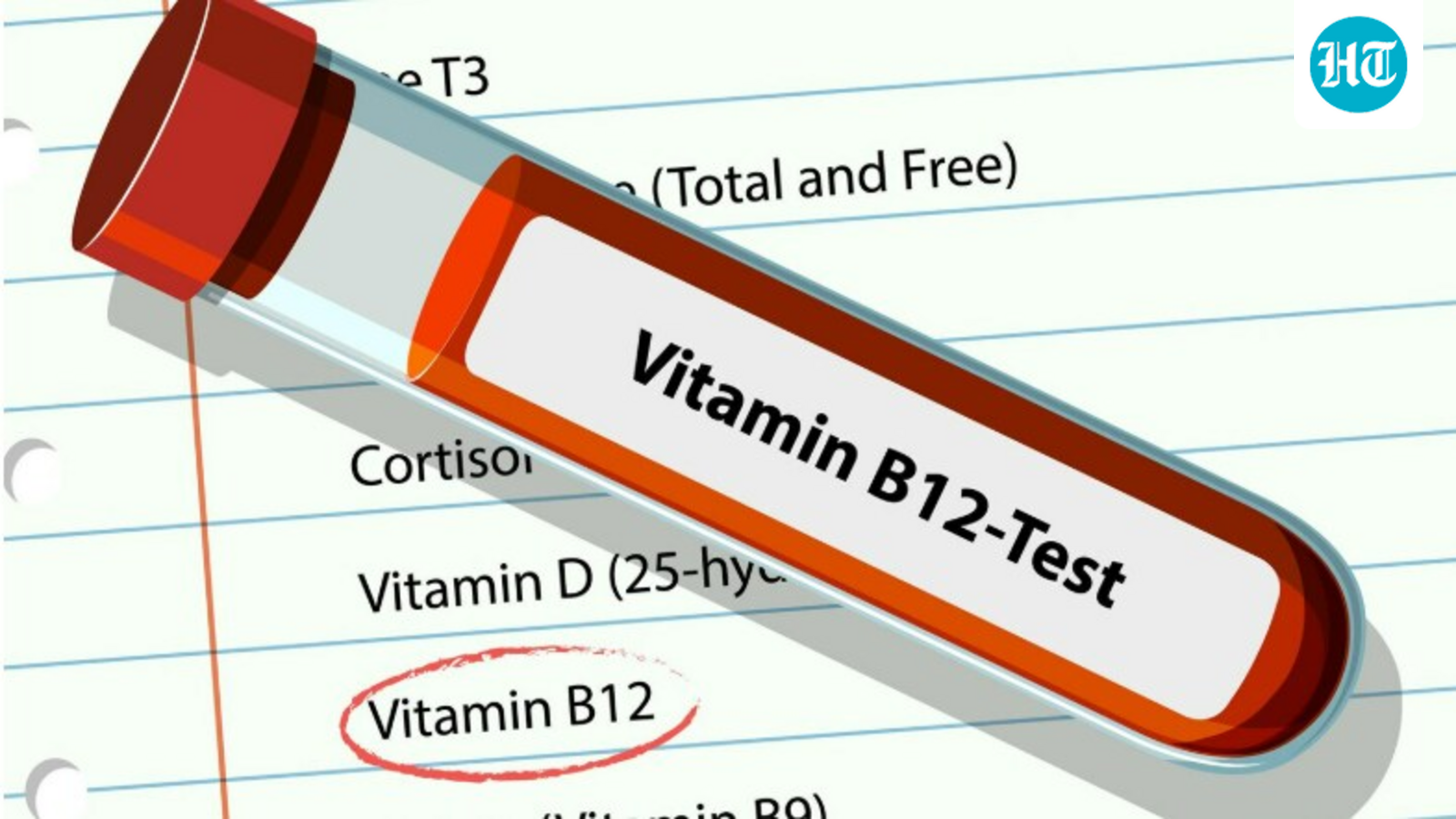 Featured image for Expert Tips on Preventing and Managing Vitamin B12 Deficiency