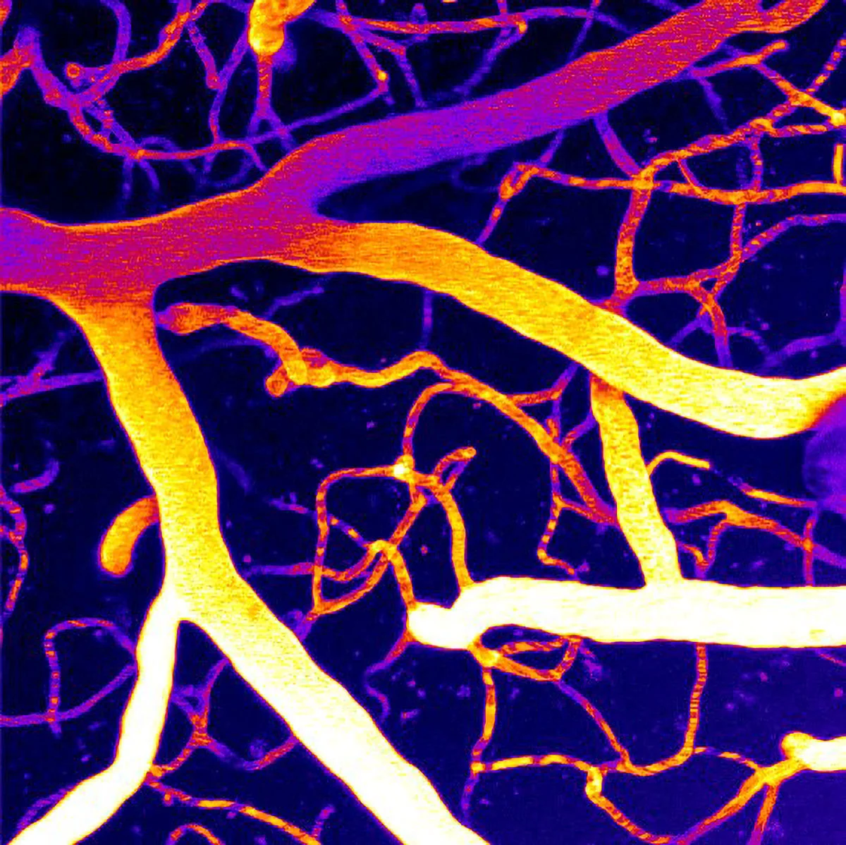 Featured image for New Brain Discovery Offers Hope for Dementia Treatment