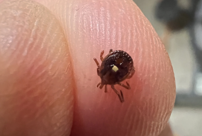 Featured image for Rise of Alpha-Gal Syndrome and Tick-Borne Allergies in the US