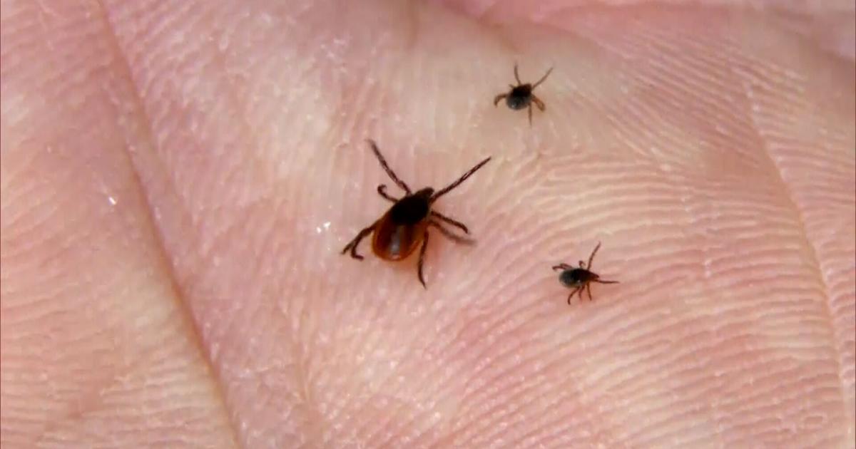Tick Troubles: Rising Lyme Disease Cases and ER Visits Spark Concern in US