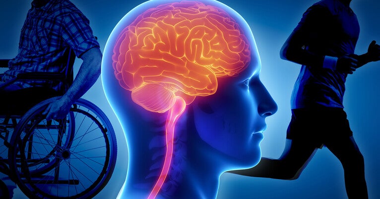 Uncovering the Genetic Link to Multiple Sclerosis Severity