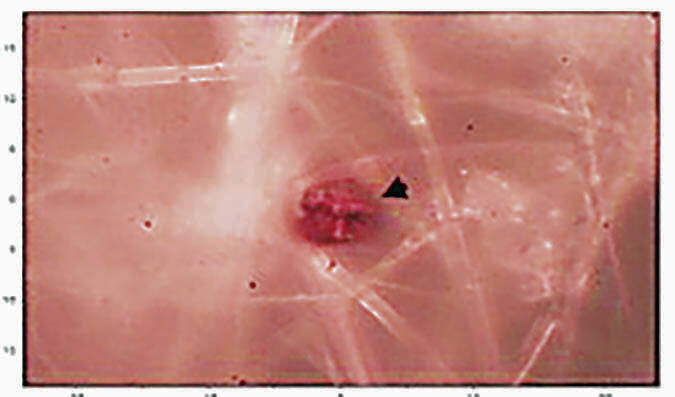 Featured image for Plastic Contamination in Local Placentas on the Rise, JABSOM Study Reveals