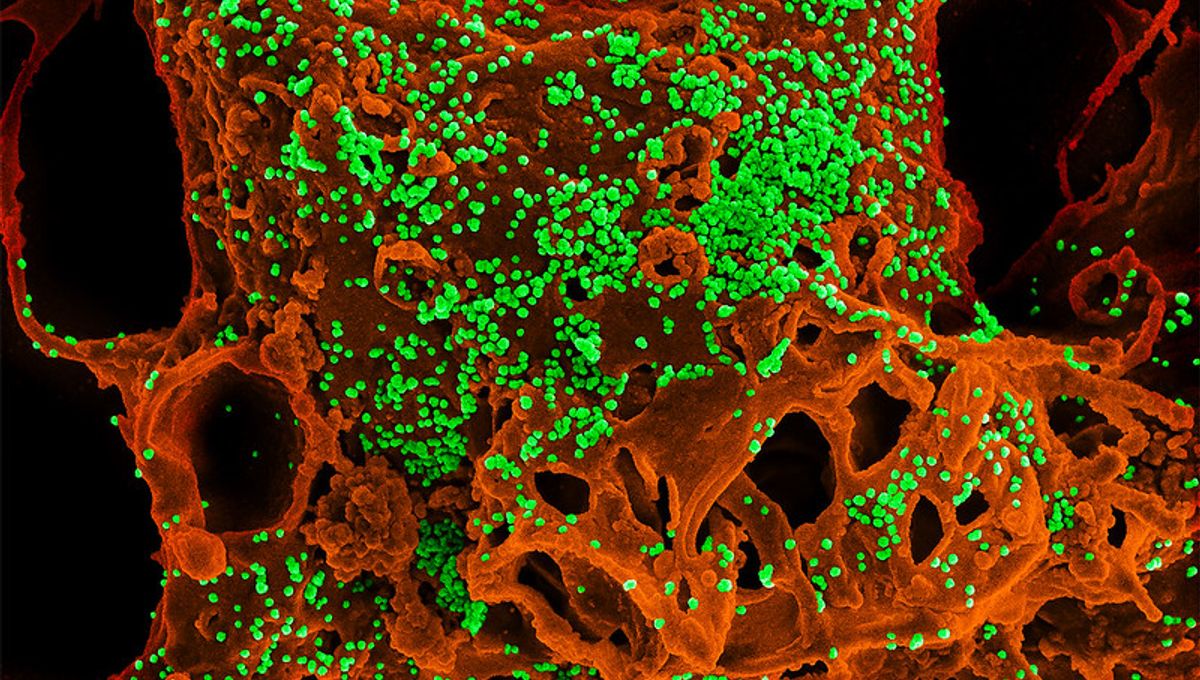 Featured image for Mysterious MERS Case: Man Tests Positive, Origin Unknown