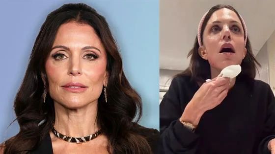 Bethenny Frankel Injures Face While Testing Beauty Tool