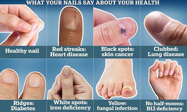 Nail Changes: A Window to Your Health