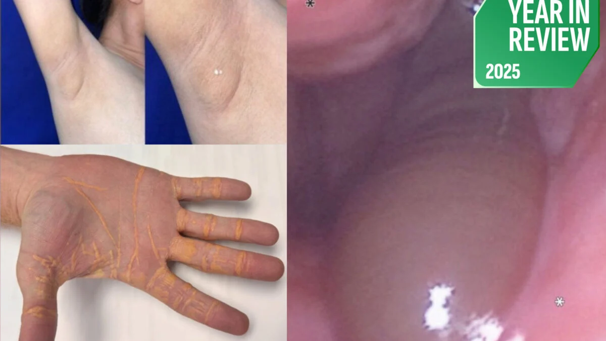 Featured image for 2025's Most Bizarre Medical Cases