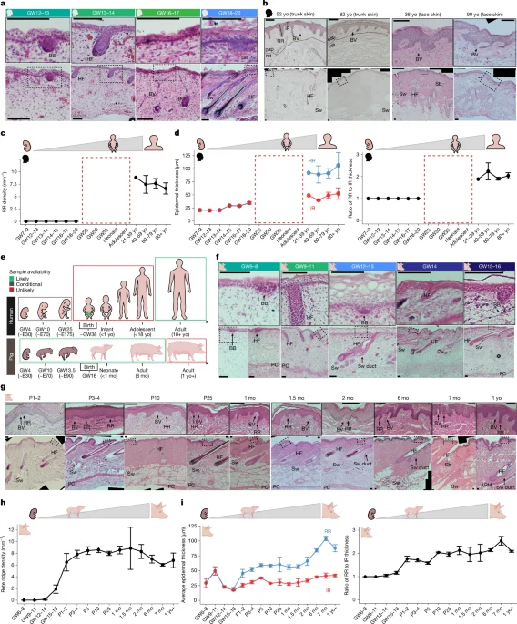 Rete ridges reveal distinct epidermal programs shaping mammalian skin