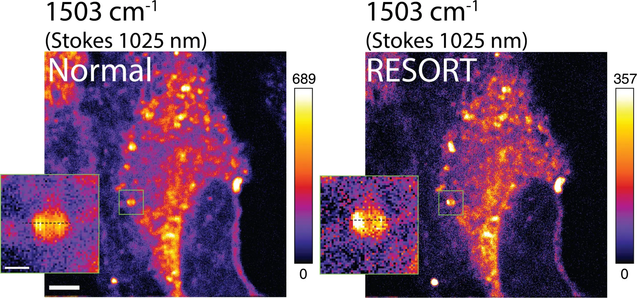 Featured image for "Revolutionary RESORT Microscopy Unveils Living Systems in Super-Resolution"