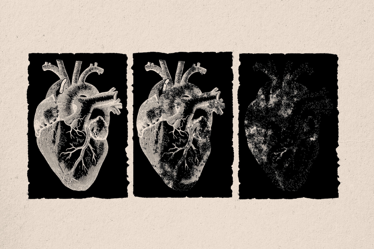 Featured image for "Long-term Risk: Chemotherapy Linked to Future Heart Disease in Cancer Survivors"