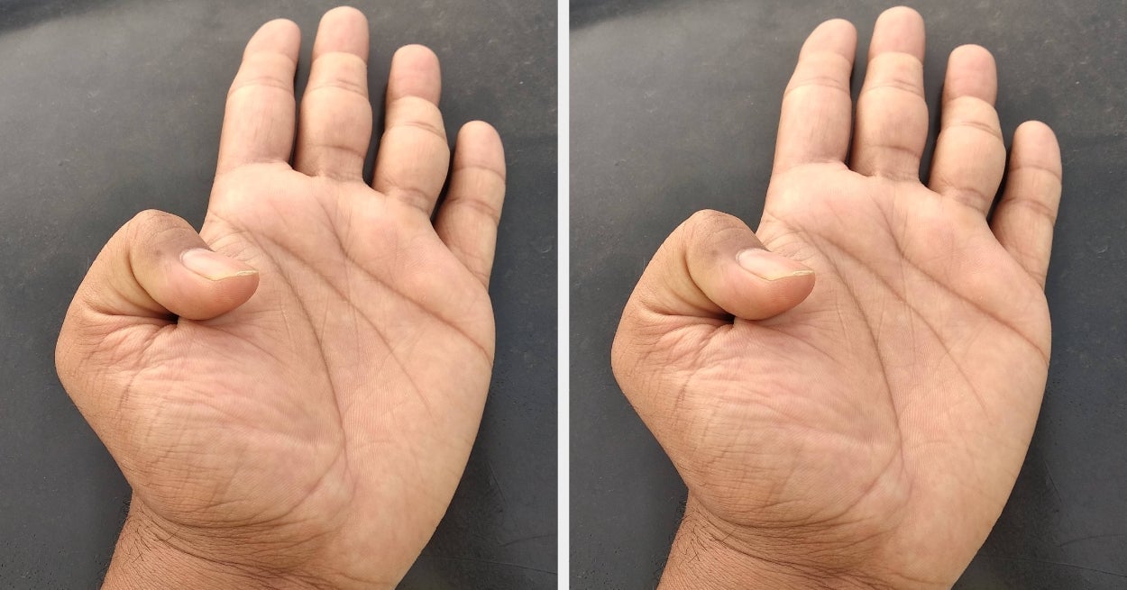 Featured image for Quick Thumb Test Reveals Heart Risk: How to Do It at Home