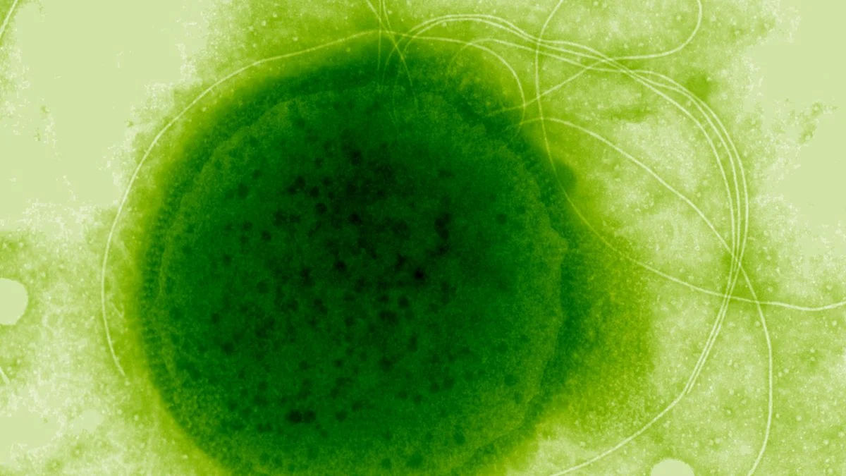 Deep-Sea Archaea Survive Extreme Radiation: A Byproduct of Hydrothermal Vent Life