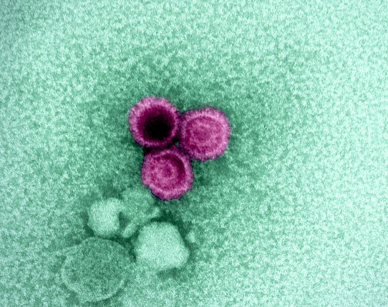 Featured image for "Identifying Vulnerabilities: NIH Scientists Uncover Weaknesses in Epstein-Barr Virus"