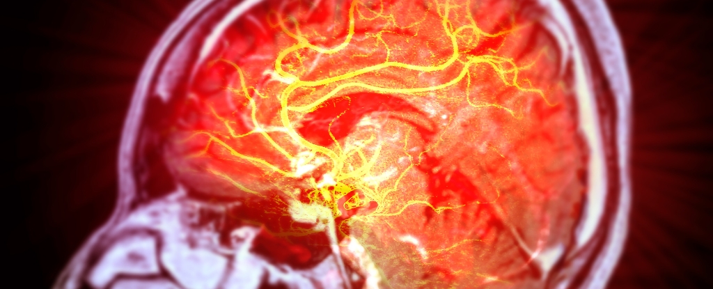 Featured image for Stem Cell Therapy Shows Promise in Reversing Stroke Damage in Mice