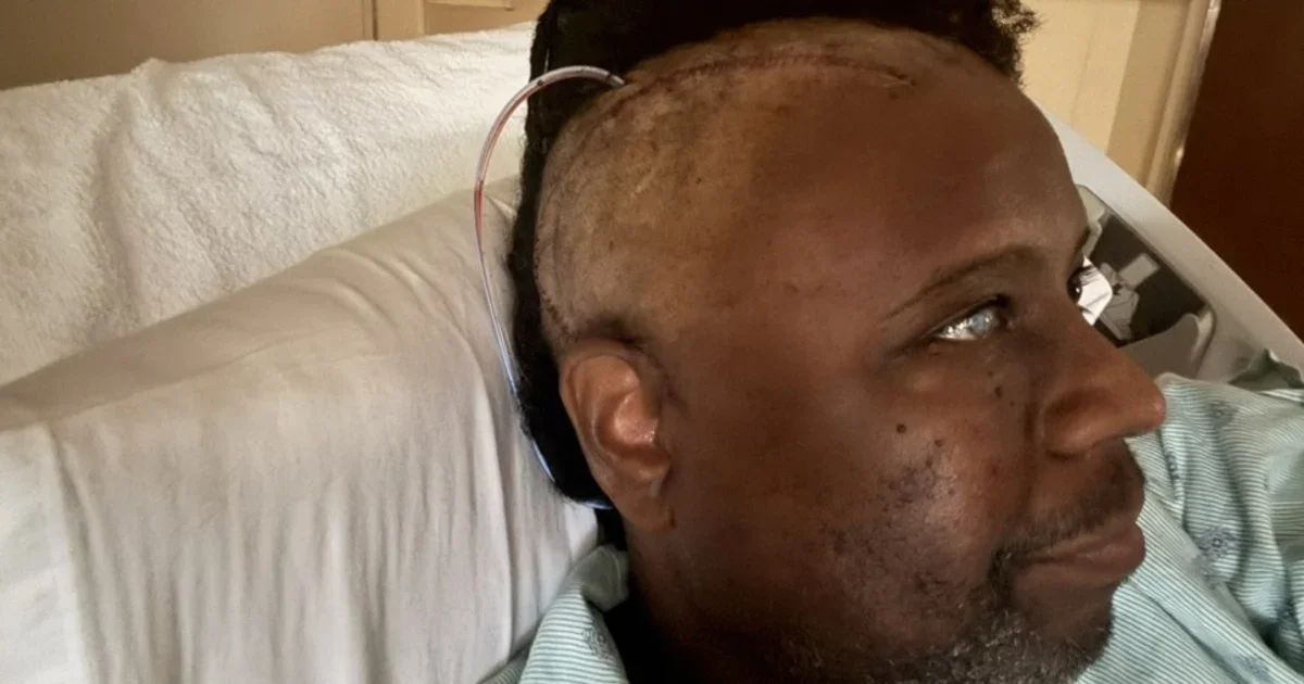 Lawyer Survives Giant Brain Tumor After Sudden Collapse