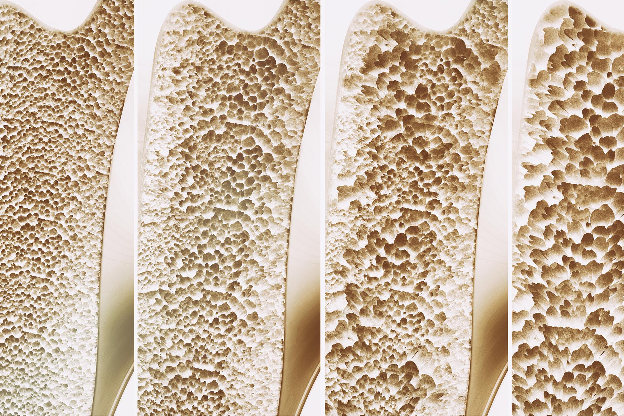Featured image for Scientists Discover Bone 'Switch' to Reverse Osteoporosis