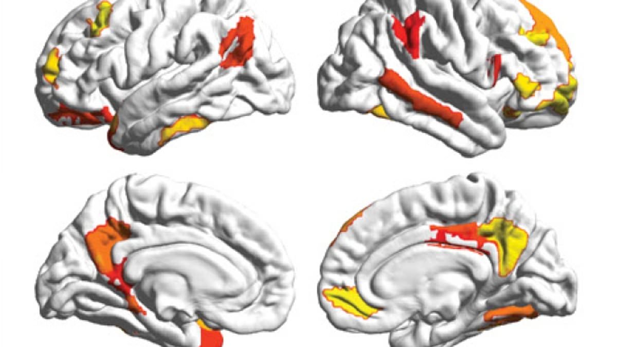 Featured image for "Brain Scans Confirm Gender-Based Differences in Neural Organization"