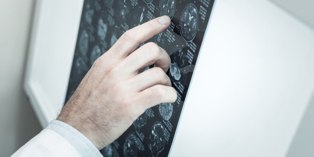 Medicare's Alzheimer's drug coverage policy hinges on patient data.