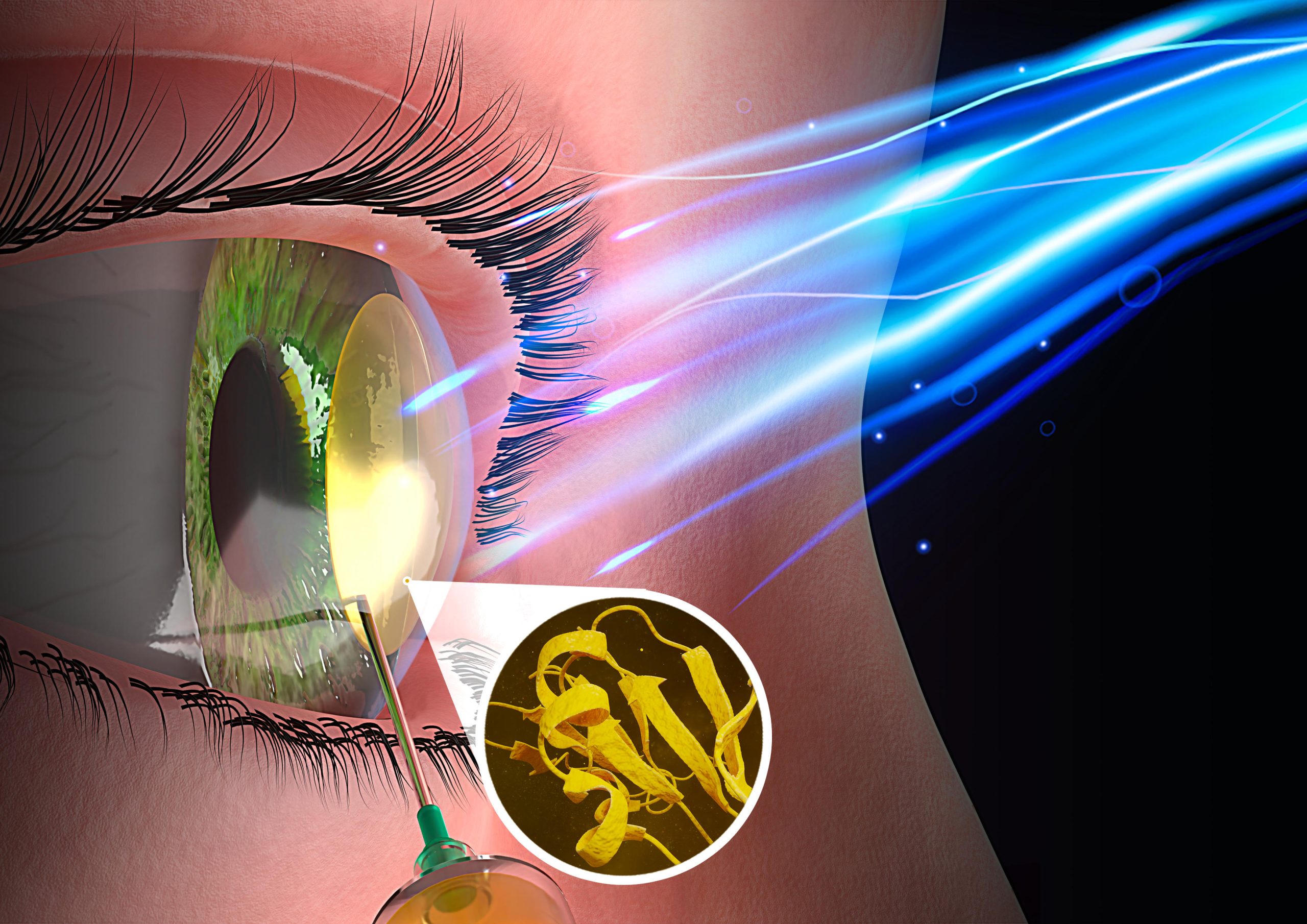 Featured image for Harnessing Low-Energy Blue Light for Cornea Regeneration: Canadian Breakthrough